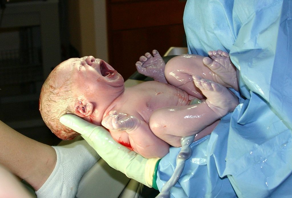 neonato parto